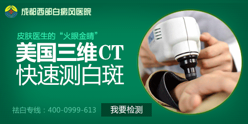 成都治白癜风哪家医院最好
