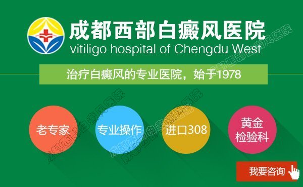 成都白癜风哪个医院好